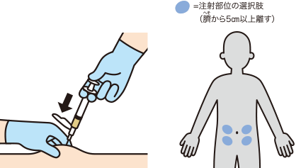 皮下注射方法と注射部位の選択肢